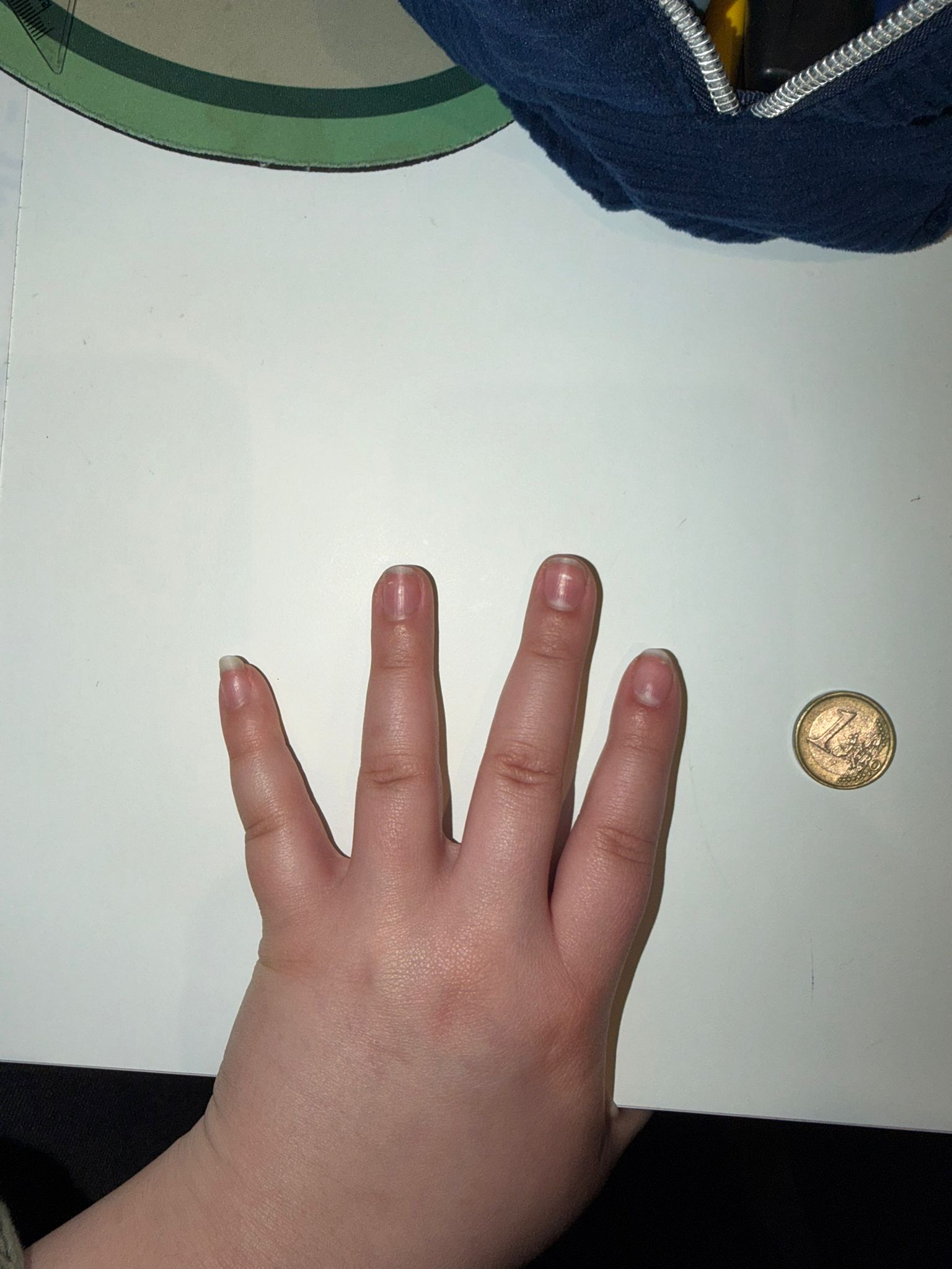 Hand example
